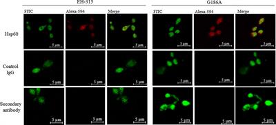 Heat Shock Protein 60, Insights to Its Importance in Histoplasma capsulatum: From Biofilm Formation to Host-Interaction